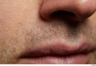 HD Face skin references Josh Hart lips mouth nose skin…